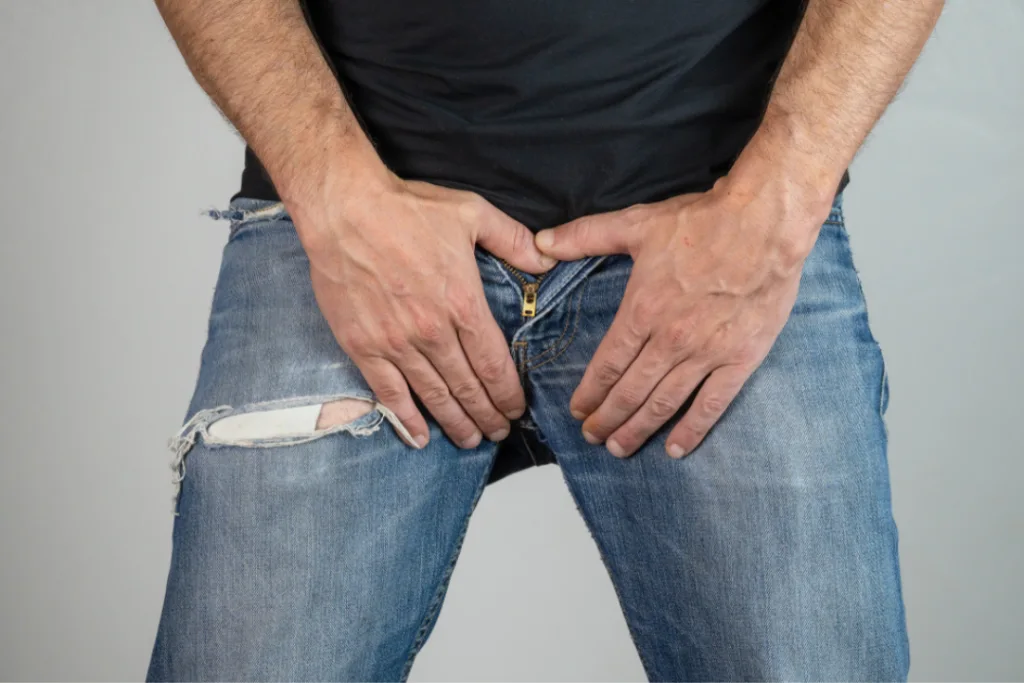 Φίμωση-Περιτομή