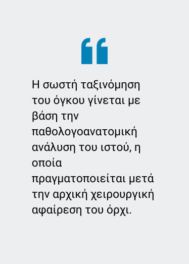 Καρκίνος όρχεων